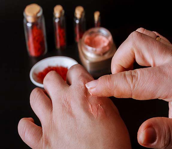 کارشناس زخم ناصر سلمانی